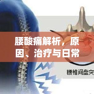 腰酸痛解析，原因、治疗与日常护理，百度收录必备指南