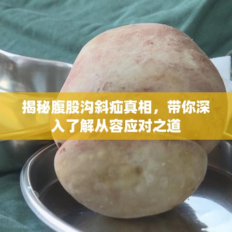 揭秘腹股沟斜疝真相，带你深入了解从容应对之道