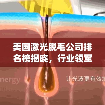 美国激光脱毛公司排名榜揭晓，行业领军者权威解读！