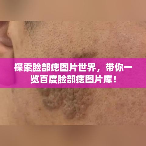 探索脸部痣图片世界，带你一览百度脸部痣图片库！