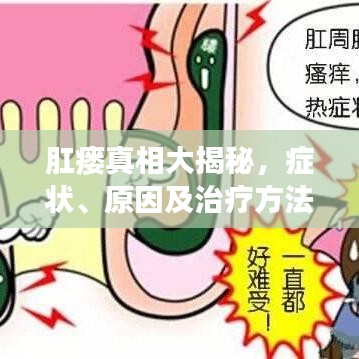 肛瘘真相大揭秘，症状、原因及治疗方法，百度权威解读！